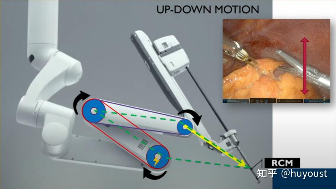 达芬奇手术机器人关键技术浅析：结构篇