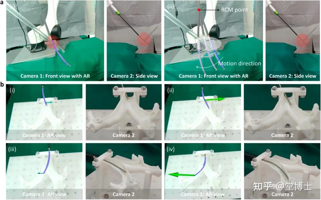 给手术机器人装上“触觉大脑”！中国团队研发光纤触觉机器人，实现介入手术“全身感知”